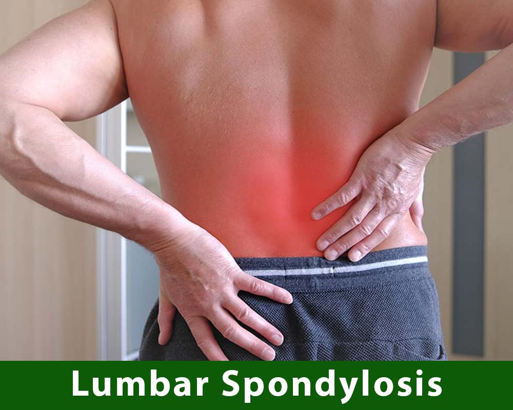 lumbar-sponditlytis